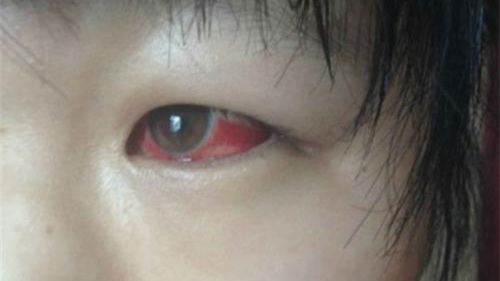 光觸媒除甲醛保護(hù)新裝修教室空氣，更保護(hù)孩子們