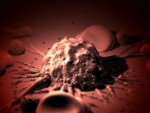 癌癥、白血病越來越多，是因為時代在進步而導(dǎo)致的嗎？